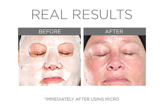 Micro defense microbiome sheet masks
